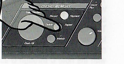 Delete button control illustration.